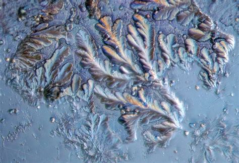 Húgysav kristályok mikroszkóp alatt