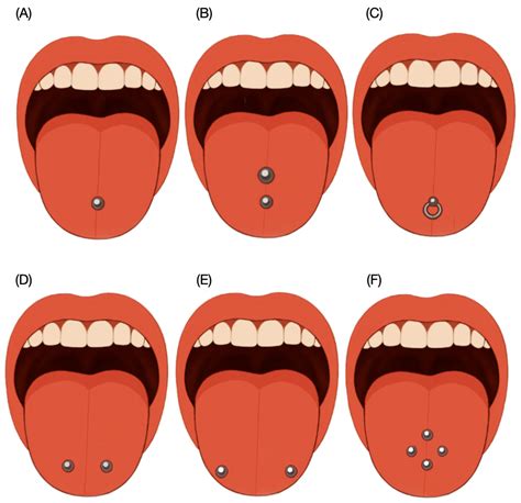 Diagram illustrating the anatomy of the tongue and common piercing placements