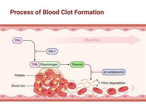 infographic illustrating blood clot formation and dissolution