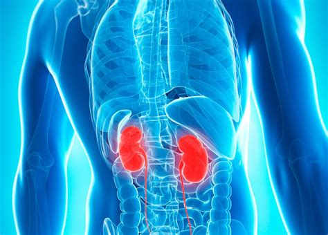 A vesekő okozta fájdalom elhelyezkedése