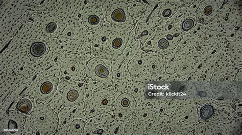 Sörélesztő sejtek mikroszkóp alatt