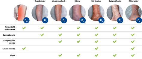 Visszér és vérrög