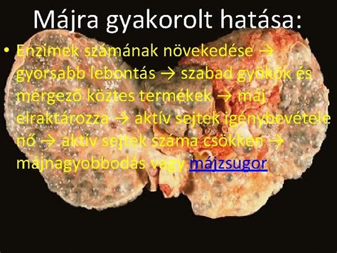 Diagram az alkohol májra gyakorolt hatásairól