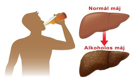 Infografika a máj funkcióiról és az alkohol hatásáról