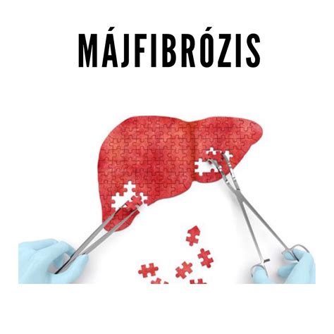 A májban zajló alkoholbontás folyamata