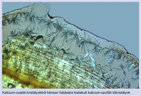 A kalcium-oxalát kő összetétele és képződése