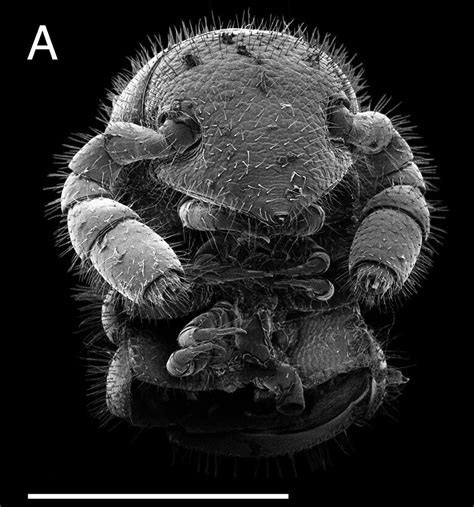 Poliovírus mikroszkópos képe