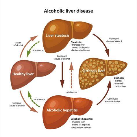 illustration of alcohol-related disorders