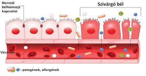 szivárgó bél és microbiom ábrája