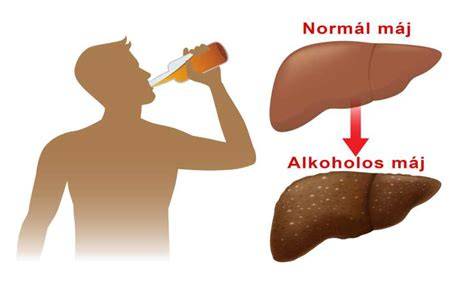 Alkoholos mérgezés tünetei (ábra)