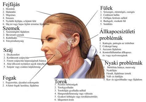 készülékes nyaki fájdalom ábrázolás